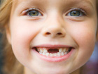 Защо млечните ни зъби падат?